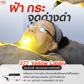 577 Yellow Laser ฝ้า