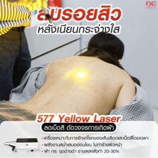 577 Yellow Laser หลังใส Size S